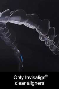 56K views | Get ready for something great. Start with your smile. Discover Invisalign clear aligners. | Invisalign UK & Ireland | Facebook