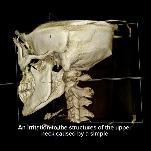 Struggling with involuntary neck movements or muscle tightness?.