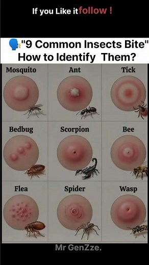 How to Identify the common insects Bites#facts#viralshorts#fyp