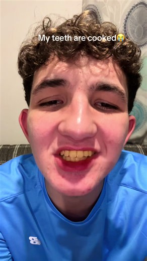 Teeth Whitening Results That Will Shock You