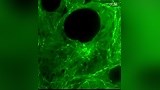 细胞内的彗星图 微管动态 microtubule dynamics
