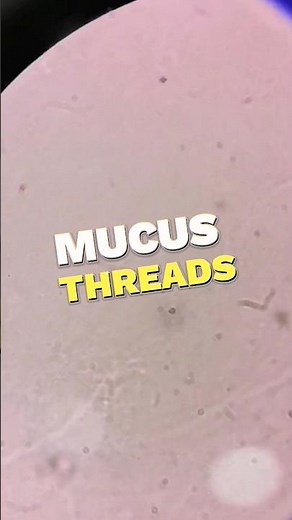 Mucus threads in urine under the microscope #laboratory #microscope #mls #cls #medtechstudent