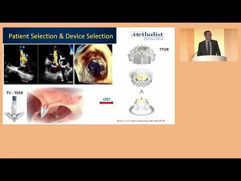 35th Annual Edler Lecture