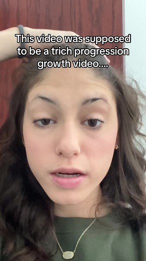 I’ve been struggling with trichotillomania since I was in 8th grade. I dont even know I’m pulling before its too late. I started my second year of college with having a stress free summer and the pulling just restarted like I hoped it wouldn’t. I would love to not wake up every morning and drawing in my eyebrows be the first thing I have to do. I’m posting this video only because I dont want people to feel alone in this struggle and that they arent making any progress. Because we are. Slowly but