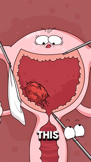 How Doctor Remove Tumors Through the Belly Button 🤯😱..!!#shorts #2dshow #fypシ #funny #health