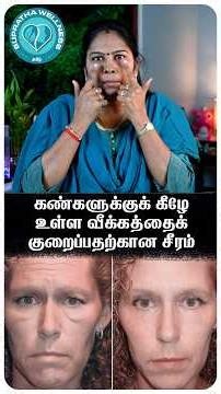 Festoon Bags Under Eyes? கண்களுக்குக் கீழே உள்ள வீக்கத்தை குறைக்கும் இயற்கை சீரம்