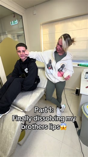 Dissolving My Brother's Lip Filler Journey