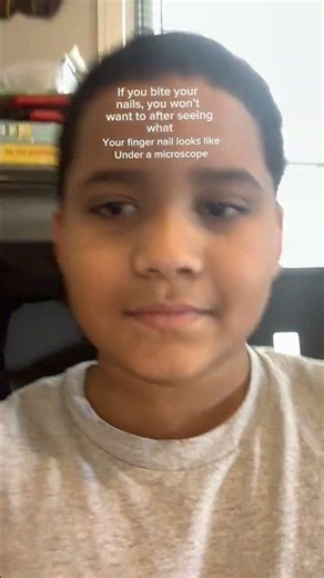 What a fingernail looks like under a microscope 😨￼