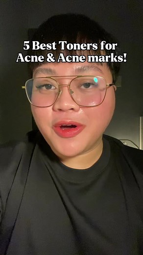 5 Best Toners for Acne and Acne Marks! 🤍