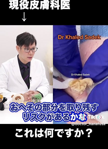 背中の粉瘤除去とその治療法
