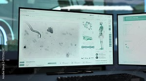 Virology Analysis System Examining Parasitic Worm In Patients Organism. Visualization Of Parasitic Worm In Virology Analysis Software. Virology Analysis Laboratory Scanner Researching Parasitic Worm