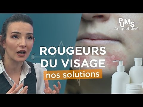 Plaques rouges, pellicules blanches.. SOIGNER la DERMITE SÉBORRHÉIQUE avec notre Dermato (+ routine)