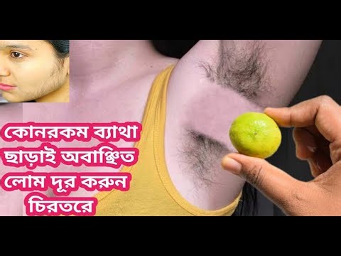 মাত্র ২ মিনিটে মুখের অবাঞ্ছিত লোম দূর করার ঘরোয়া উপায় |Facial hair removal home remedy|Unwanted Hair