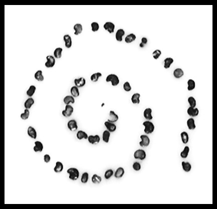 Frozen Section Technique I — Pathology Innovations