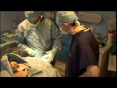 Hypnosurgery Live - Dentistry Clip.mpg