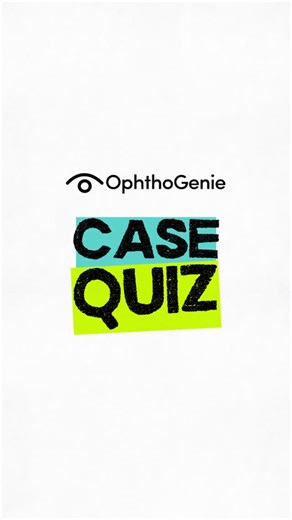 OphthoGenie on Instagram: "Case File: OPEN 📂 Think you can solve it? #ophthalmology #ophthalmologycases #ophthalmologychallenge #ophthalmologylife #ophthogenie"