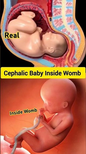 Baby's Position in the Womb: Cephalic Presentation #Cephalicbaby #babyinsidewomb #viralshortfeed