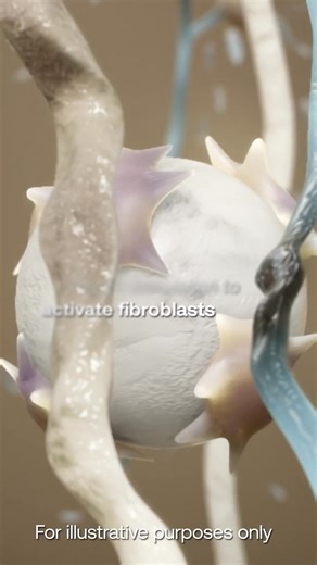 When it comes to skin health, fibroblasts matter. Here’s why ➡️ For illustrative purposes only. Source:1. Dick MK, et al. Histology, fibroblast. In: StatPearls [Internet]. Updated May 1, 2023. Accessed September 29, 2023. https://www.ncbi.nlm.nih.gov/books/NBK541065. 2. Aguilera SB, et al. Aesthet Surg J. 2023;43(10):1063-1090. IMPORTANT RADIESSE® and RADIESSE® ( ) SAFETY INFORMATION RADIESSE® and RADIESSE® ( ) are FDA-approved to smooth moderate to severe facial wrinkles and folds, such as naso