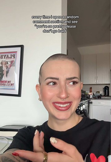 Bald is Beautiful: Embracing Alopecia with Confidence