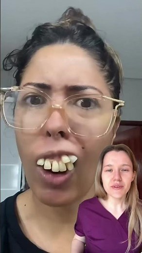 What is hyperdontia?