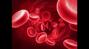 5.2K views · 113 reactions | What is Leukemia? What are the causes, symptoms and methods of treatment? WATCH Sri Lanka's only Consultant Clinical Haematologist/ Haemato-oncologist Dr. Saman Hewamanna explain. | Lanka Hospitals PLC | Facebook