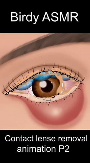 Birdy Finch ASMR on Instagram: "contact lense removal p2 #asmr #animation #viral #trending #shorts 36 sec"