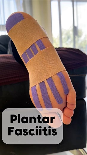 1.2M views · 3.9K reactions |  Relieve pain from the sole up.Kinesiotape for plantar fasciitis helps reduce tension, improve circulation, and provide support to the foot’s arch.✨ Take every step with more comfort and less pain.#Physiotherapy #Kinesiotape #PlantarFasciitis #fblifestyle | Kinetape Academy | Facebook