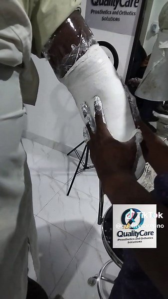 Mr. Rashid hand prosthesis casting 🇬🇭 He was attacked by armed robbers, and unfortunately, during the struggle, one of the robbers used a chainsaw to cut his left hand off. After surgery, his wound started healing and later he was refer to *Quality care prosthetics and orthotics solution* for transradial prosthesis (artificial hand) #ghanatiktok🇬🇭 #handprosthesis ##ghanatiktok #handicap #prosthetic #tragicstory