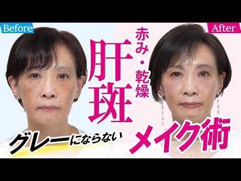 [Is This Melasma?] Solving Skin Concerns in Your 50s (Redness, Dryness, and Dullness) with Hair a...