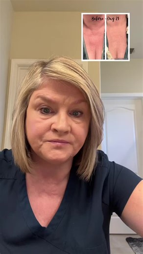 #cleanskincare #hydroxytyrosine #agegracefully #agebackwards #youthinabottle #crepyskin #nursesoftiktok #RN #turnbacktime #youthful #notoxins #nowater #over50skincare #over50tiktokker