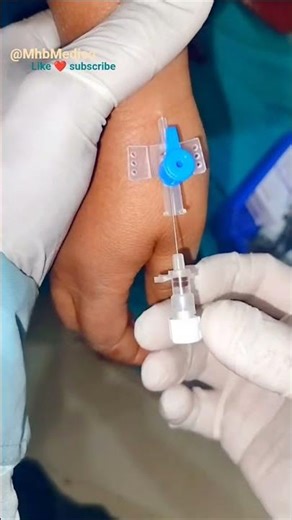 22G IV Cannula Insertion Trick 💉 Cannula Kaise Lagate Hain? #medical #shorts #nurse #viralshorts