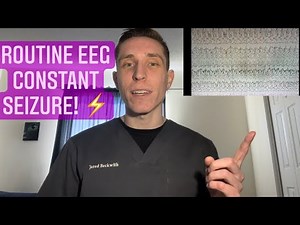 Routine EEG Patient Constantly Seizing Without Convulsions (NCSE)