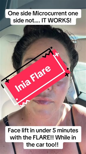 Results shock me every time!! Don’t pay full price buy this while it’s on sale :) #facelift #saggyskin #facialtreatment #microcurrent