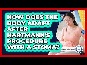 How Does The Body Adapt After Hartmann's Procedure With A Stoma? - Diverticulitis Support Network