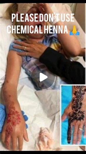 Kanchipuram_Mehandi_Artist❤️ on Instagram: "Don't use chemical henna cone 🙏 use only organic henna cone or homemade henna 🌿 .It is awareness video be safe . . . . .Do follow and support the artist #nihaa_mehandi #nihaamehandi #mehandiart #mehandi_love #mehandiwolrd #mehandilook #mehandi #mehandidesign #mehandilover #mehandiforbride #nihaa #hennacone #hennastain #hennahub #hennadesign #hennaart"