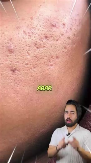 Effective Skincare and Acne Treatment for Men