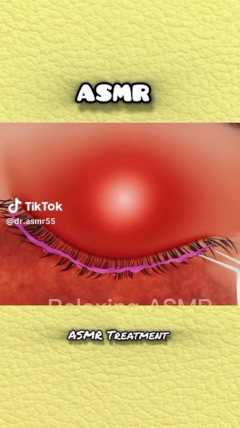 #asmrtreatment #satisfying #relaxingsounds #ASMRanimation #oddlysatisfying