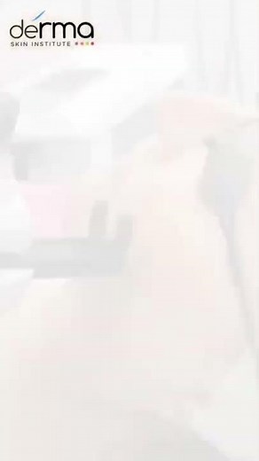 Erbium: YAG Pixel Laser Treatment Demo