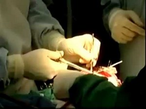 Born With Two Heads Part 3