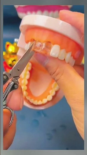 JxeJxo Moldable tooth repair kit Quick & Easy Fix for Broken Teeth but for temporary use only! #fix