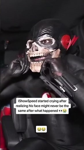 IShowSpeed started crying after realizing his face might never be the same after what happened 👀😭