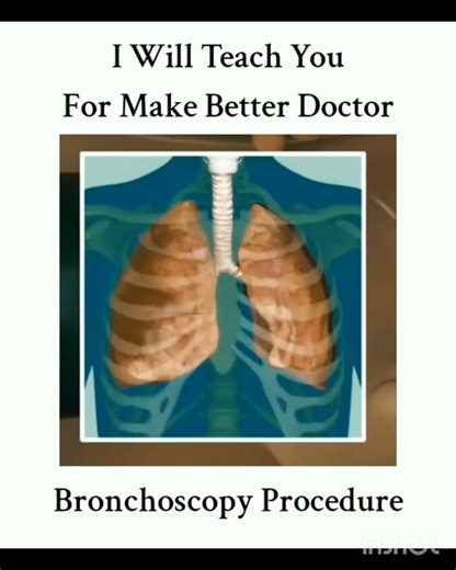 HOW TO DO BRONCHOSCOPY #doctor #entdoctor #education