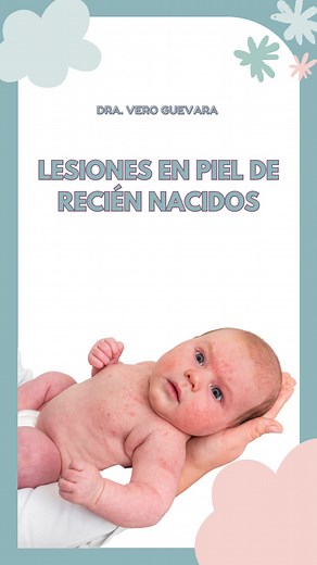 La piel del recién nacido: Su importancia y cuidados