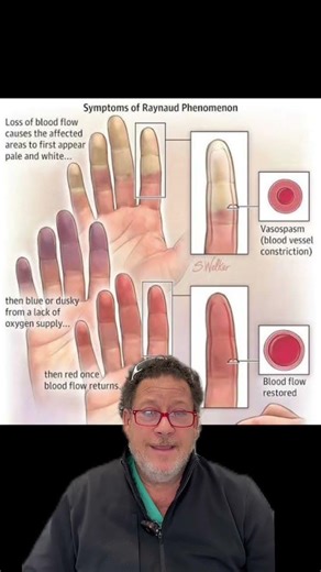 Why Is That Toe White…- Dr. Bernstein