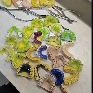 [Hot Item] Improved Hawley Retainers Dental Orthodontic Appliance Denture Lingual Retainer En Dental Lab