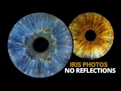 Professional eye photography tutorial | Iris photos with no reflections!