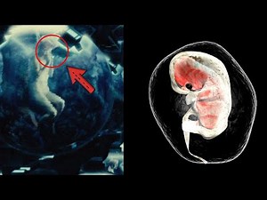 Human Cloning In Ancient India - The Mahabharata