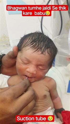 meconium suction 😢 #meconium #viralshort #adorably #baby ‪@vidhyachildcare‬