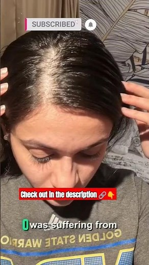 Plix Rosemary Advanced Anti Hair Fall Shampoo Review | 200ml | For All Hair Types - Men & Women