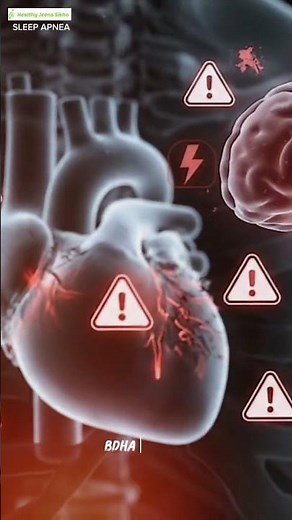 Sleep Apnea Explained | Causes, Symptoms, Risks & Treatment for Better Sleep Health